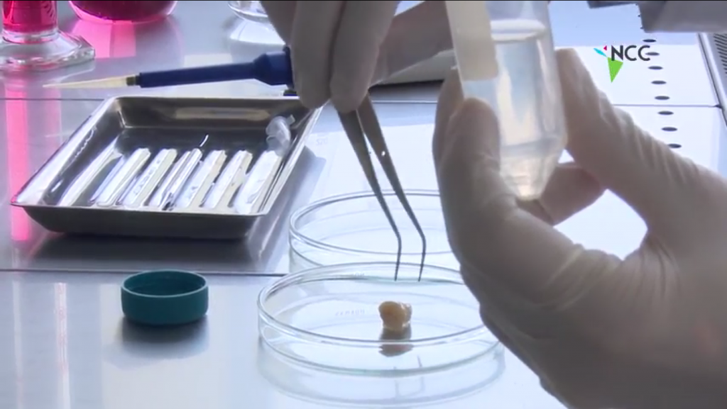 Células madre de origen dental