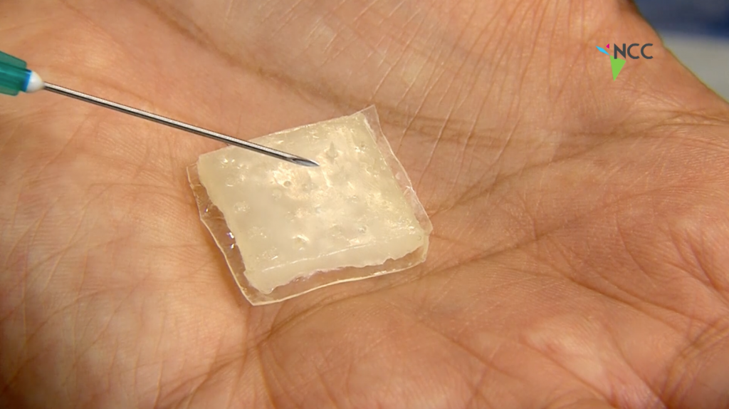 Investigadores de la UNAM crearon un parche contra el colesterol