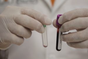 La fobia al VIH, el mayor castigo a los portadores del virus en México
