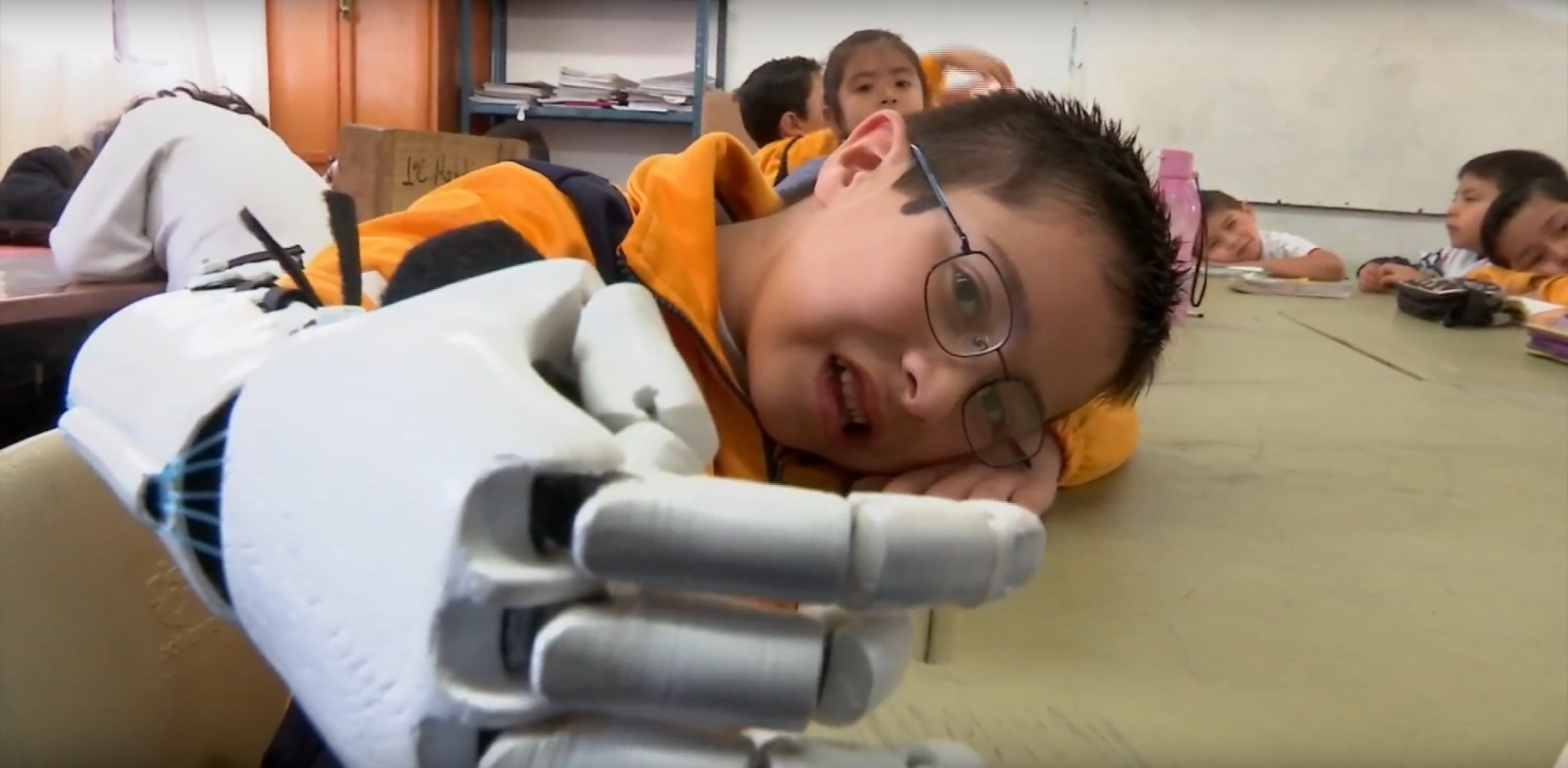 Jacobo y su mano mecánica