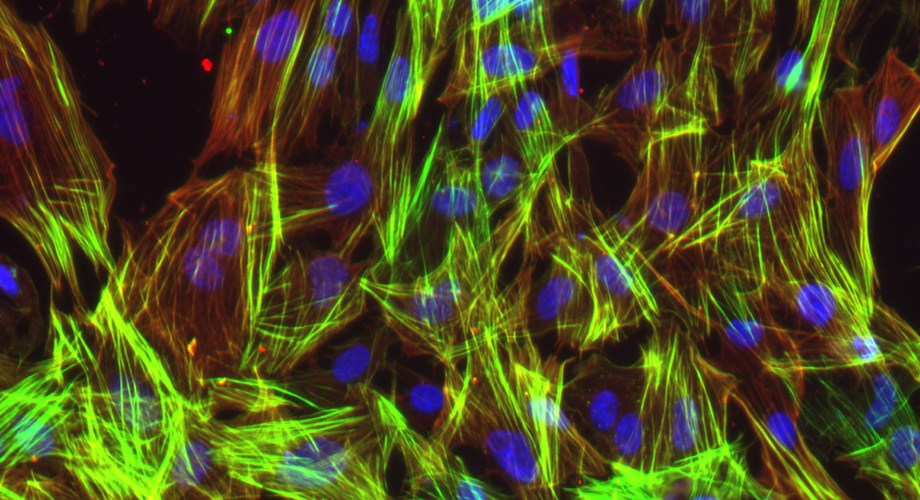 Científicos eliminan el locus del ADN factor de enfermedad cardíaca