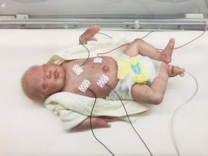 Ingenieros inventan sensores inalámbricos para los bebés en incubadoras