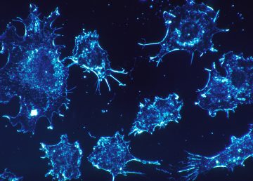 Células cancerígenas