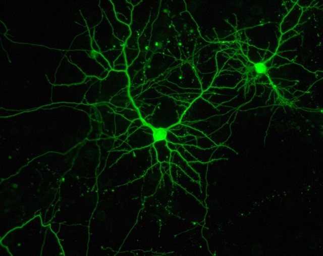 Un vanguardista proyecto usará la luz para tratar lesiones cerebrales