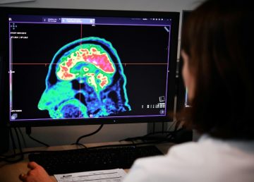 Estudio descubre mecanismo del cerebro para regular la sensación de dolor