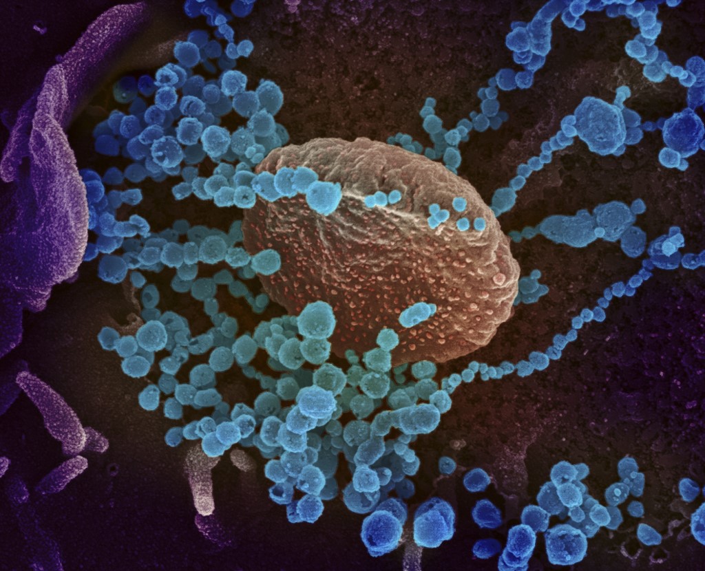 Investigadores observan por primera vez la respuesta inmunitaria al coronavirus