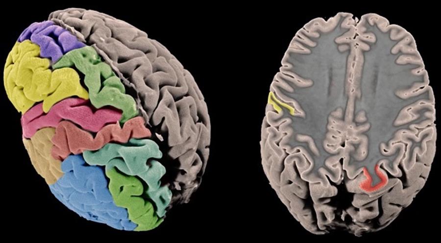 Avanzan en el conocimiento del mapa genético de la materia gris