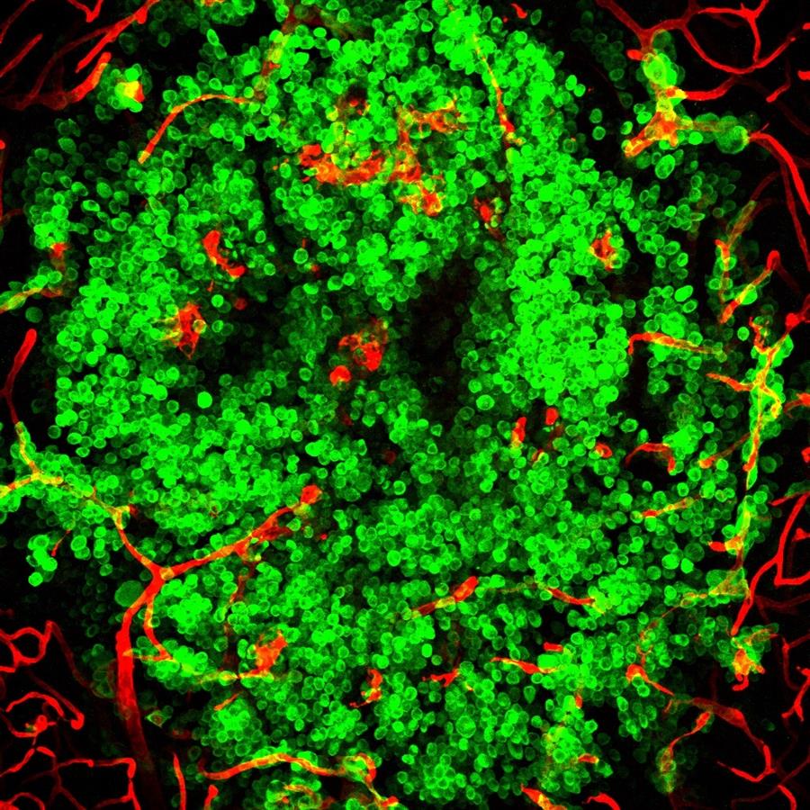 Una nueva plataforma agilizará la investigación en metástasis cerebral