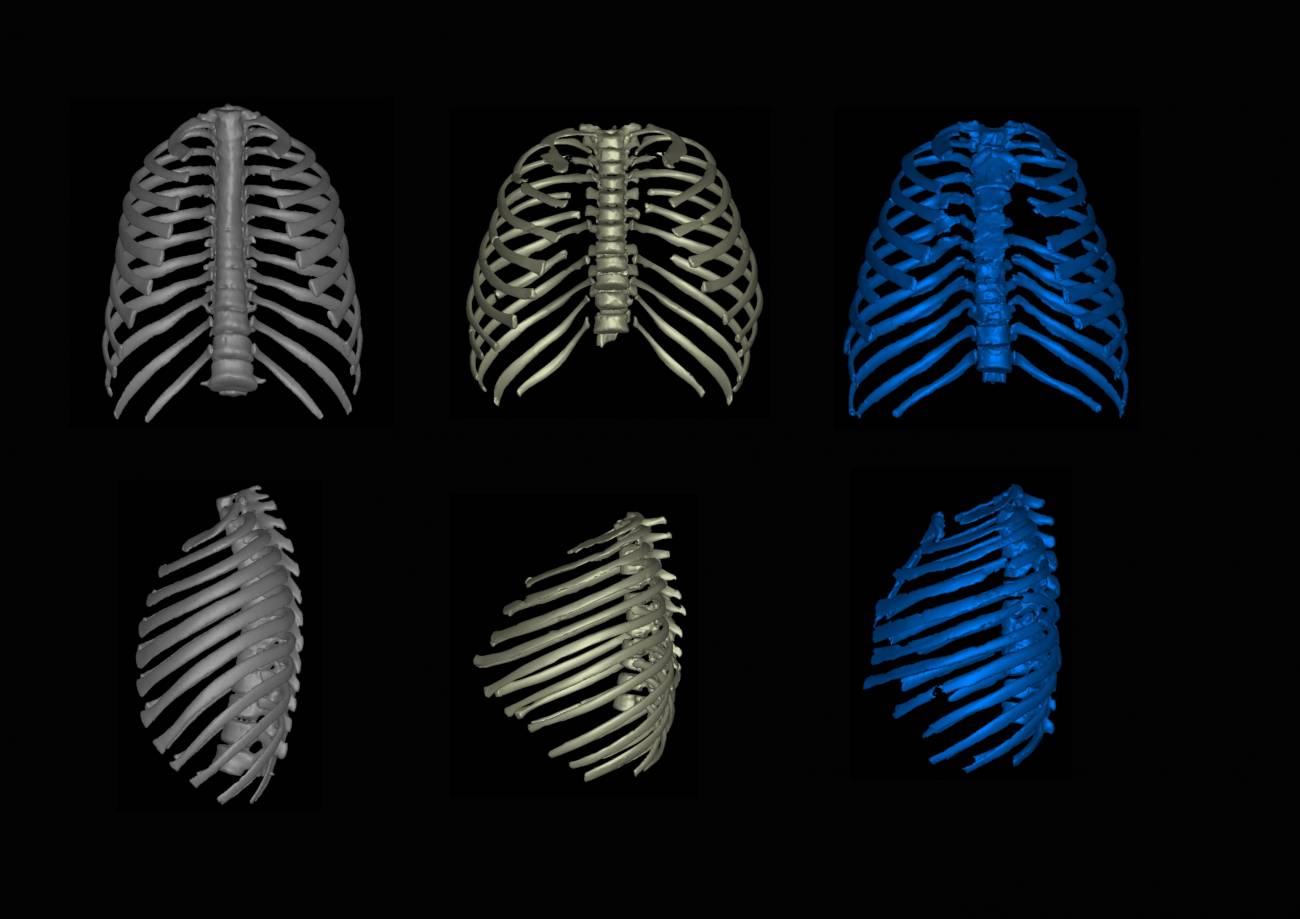 El Homo erectus no era esbelto y ligero como creíamos