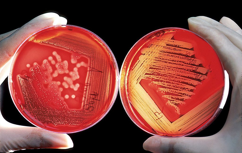 Universidad Javeriana desarrolla fitomedicamento contra el coronavirus