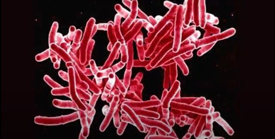 En México se trabaja para detectar la tuberculosis a tiempo y salvar vidas 