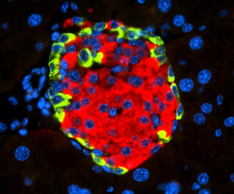 Identifican el mecanismo que explica cómo un virus puede causar diabetes