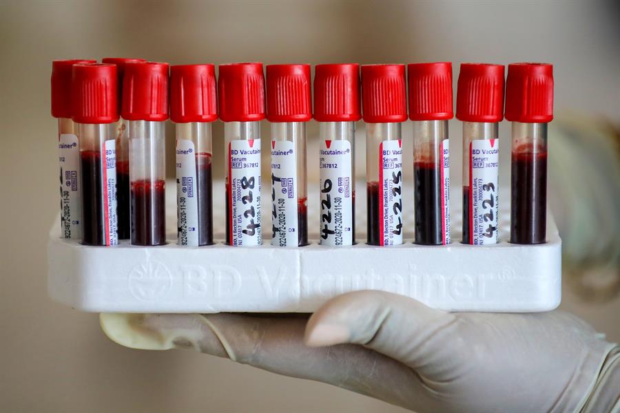 Una prueba de sangre podría predecir el desarrollo de alzhéimer