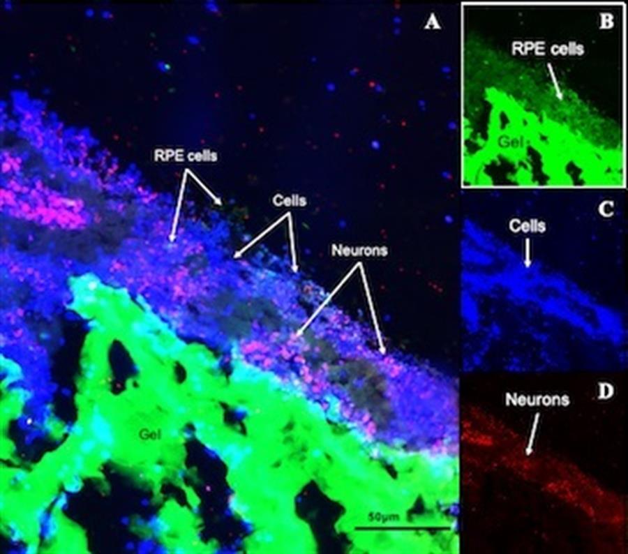 Construyen retina artificial con seda para tratar una degeneración de mácula