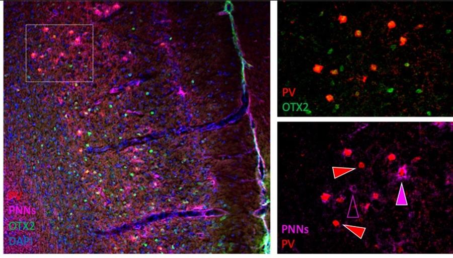 Desentrañan el mecanismo cerebral que regula la ansiedad