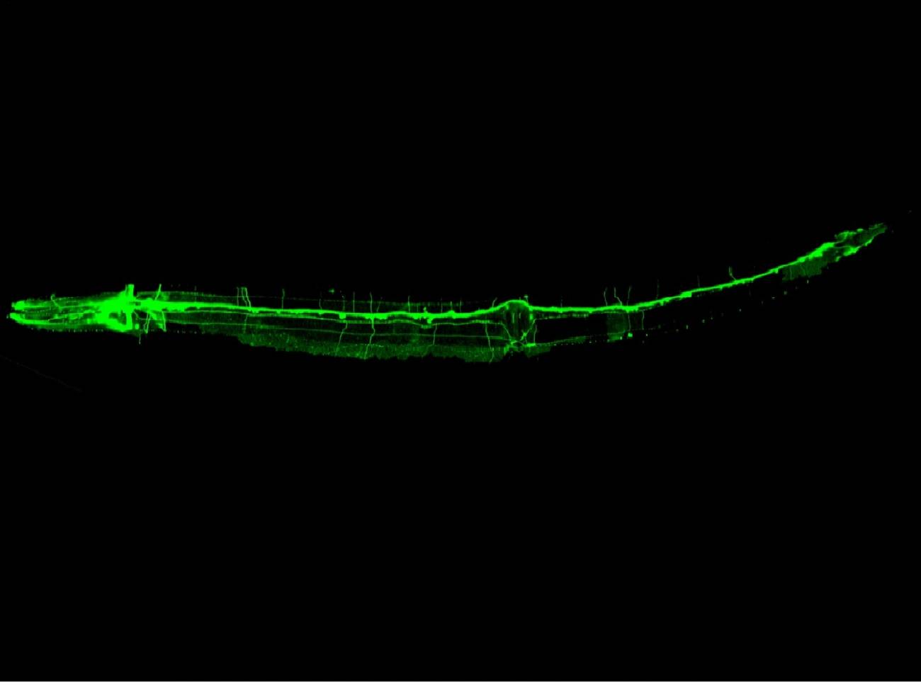 Descubren un nuevo mecanismo en la formación de neuronas sensoriales