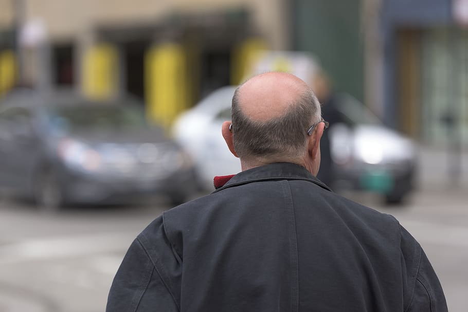 Tener más o menos cabello no determina tu riesgo a COVID-19