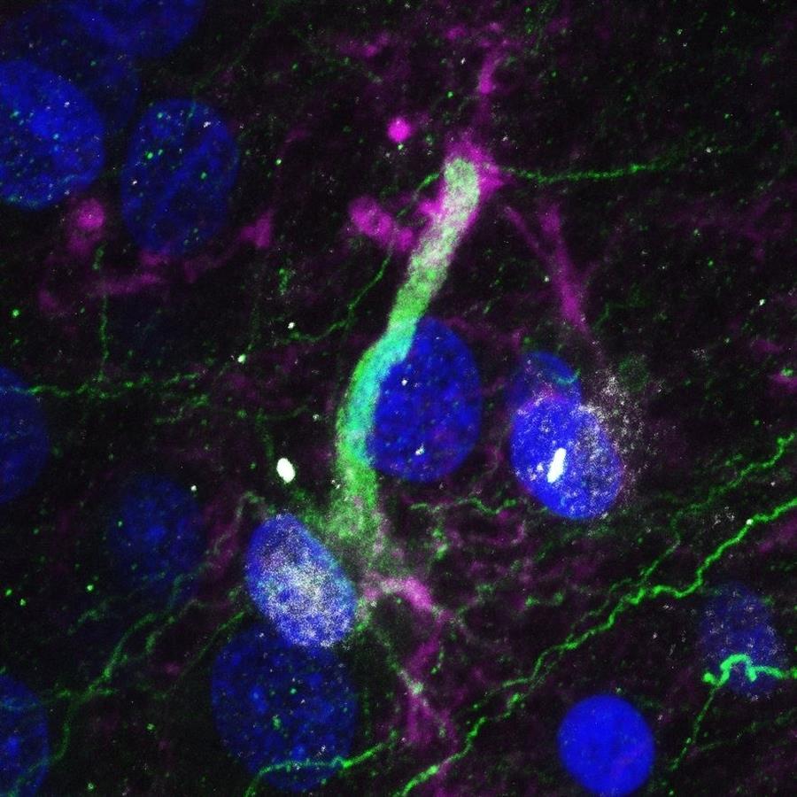 Demuestran la existencia de células madre en el hipocampo del cerebro humano