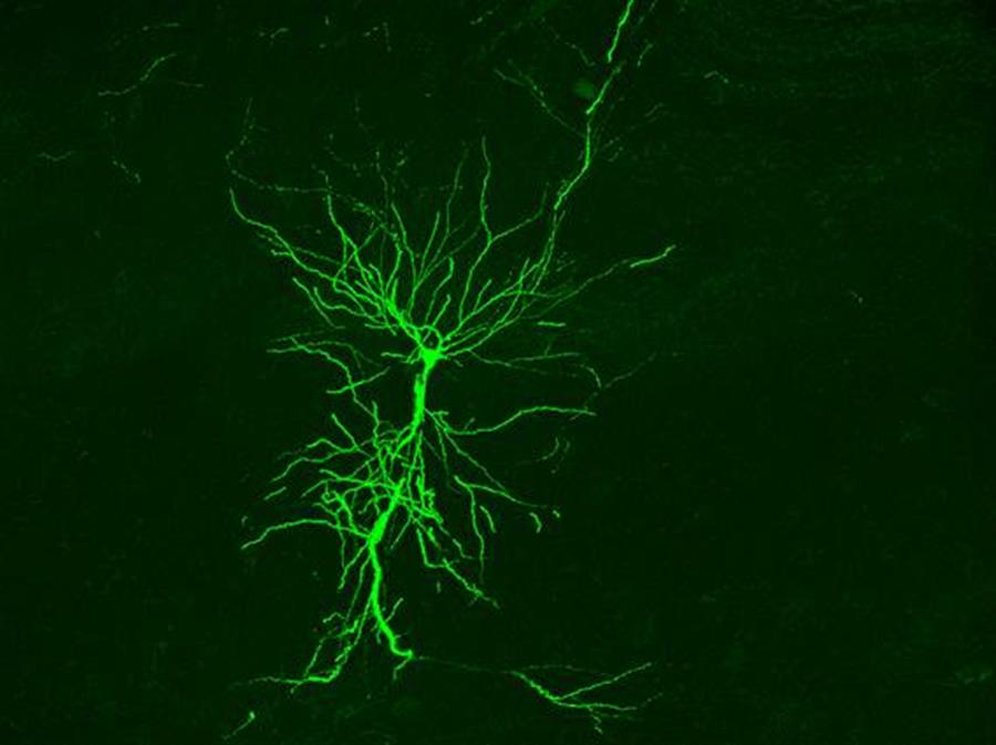 Crean una sonda que emplea la luz para diagnosticar patologías cerebrales