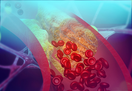 Descubren una proteína que previene el desarrollo de placas en las arterias