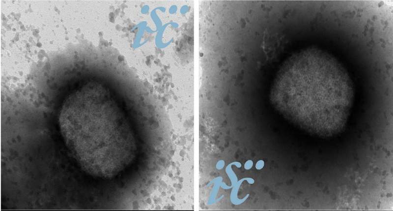 Obtienen la secuencia completa del virus de la viruela del mono en España