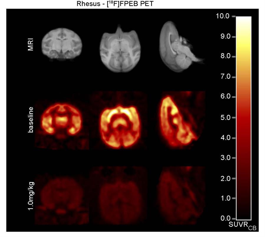 Un compuesto probado en ratones revierte daños del alzhéimer en las neuronas