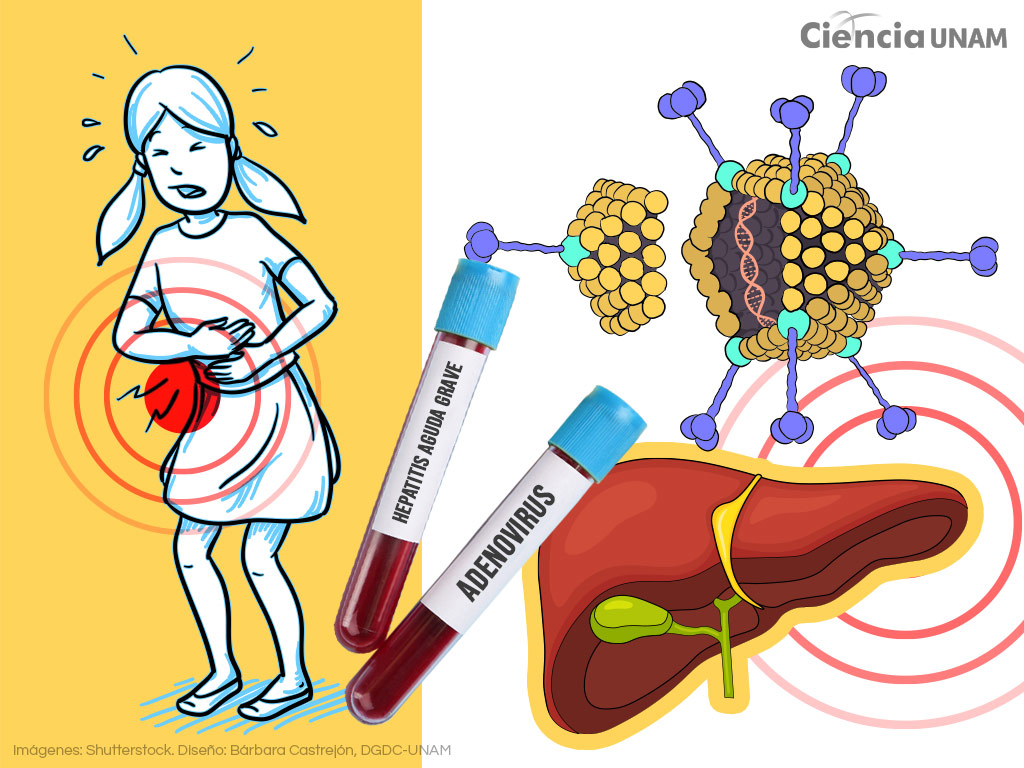 Posibles causas de la hepatitis aguda infantil