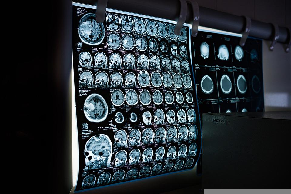 Describen por primera vez señales mecánicas del desarrollo de corteza cerebro