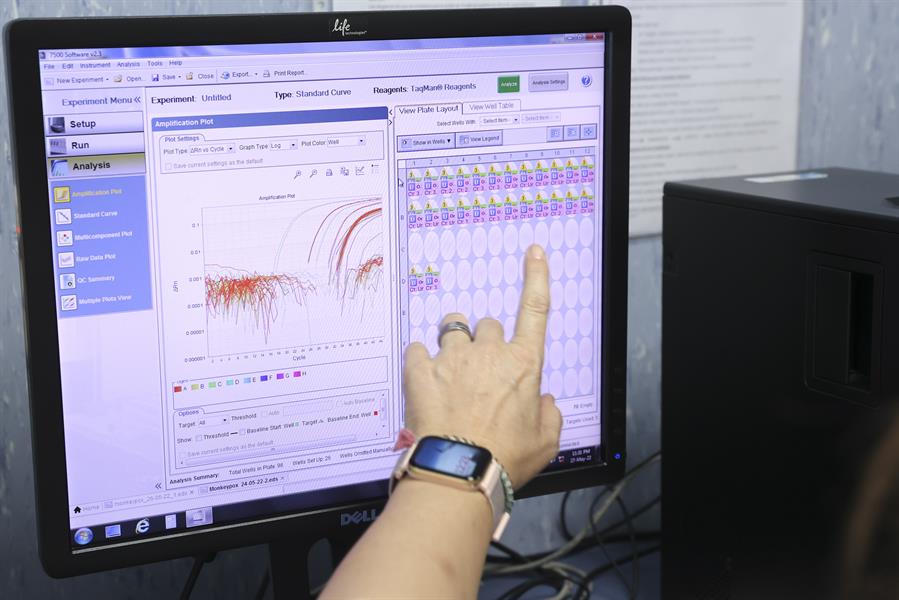 Perú logra secuenciar virus de la viruela símica del primer caso confirmado