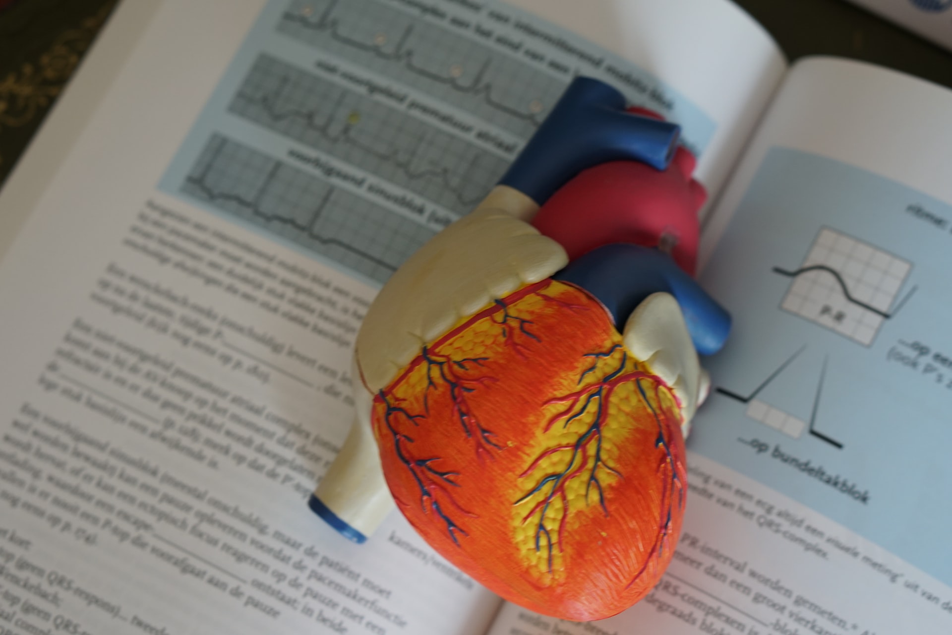 Descubren nuevas claves sobre la miocardiopatía dilatada genética