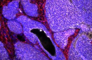 Nanoparticulas-para-el-tratamiento-y-seguimiento-de-la-inmunoterapia-contra-el-cancer