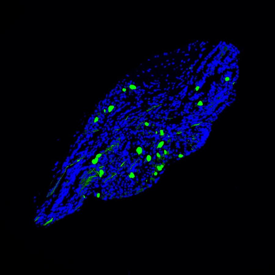 Una conexión cerebro-intestino impulsa el deseo de comer grasas