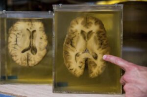 4ed3570a92e48964a49ef84b14d1d60156a79903miniw