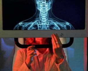 osteoporosis-EFE-DPA-EP-Bernd-Thissen