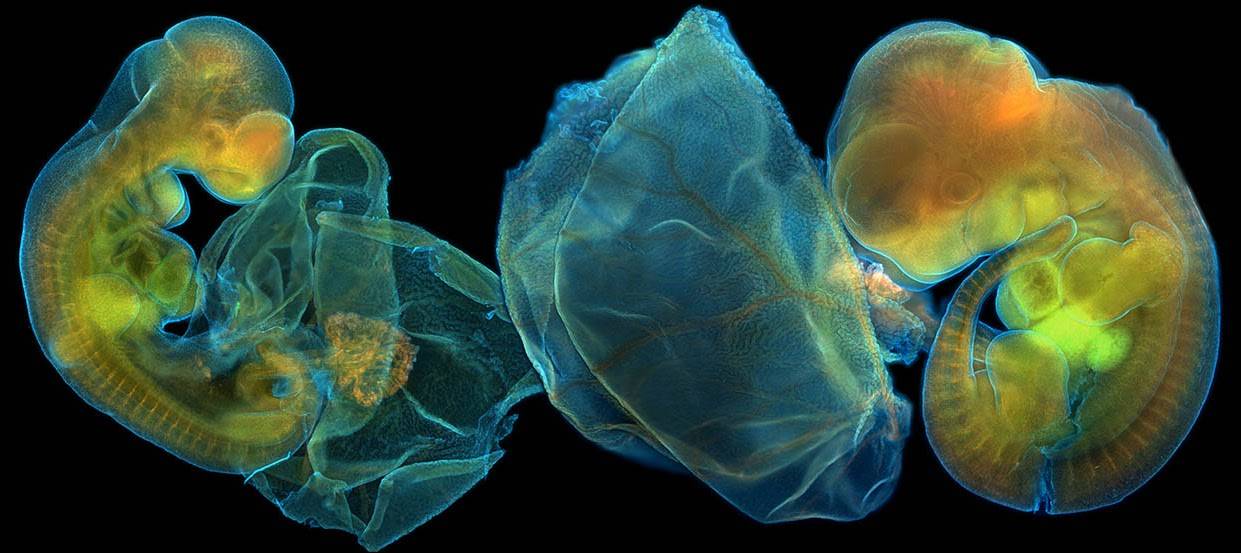 Fotomicrografía: arte y ciencia para revelar la belleza oculta de lo pequeño