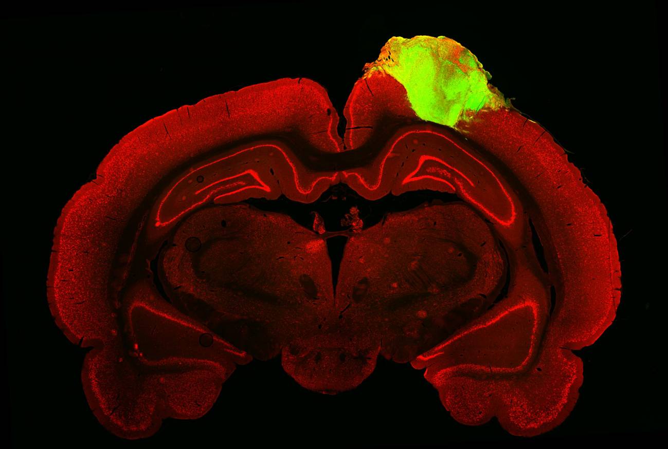 Organoides cerebrales humanos responden a estímulos visuales al trasplantarlos en ratas