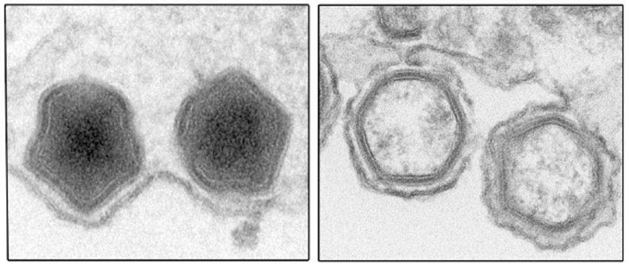 Identifican un mecanismo clave en el virus de la peste porcina africana