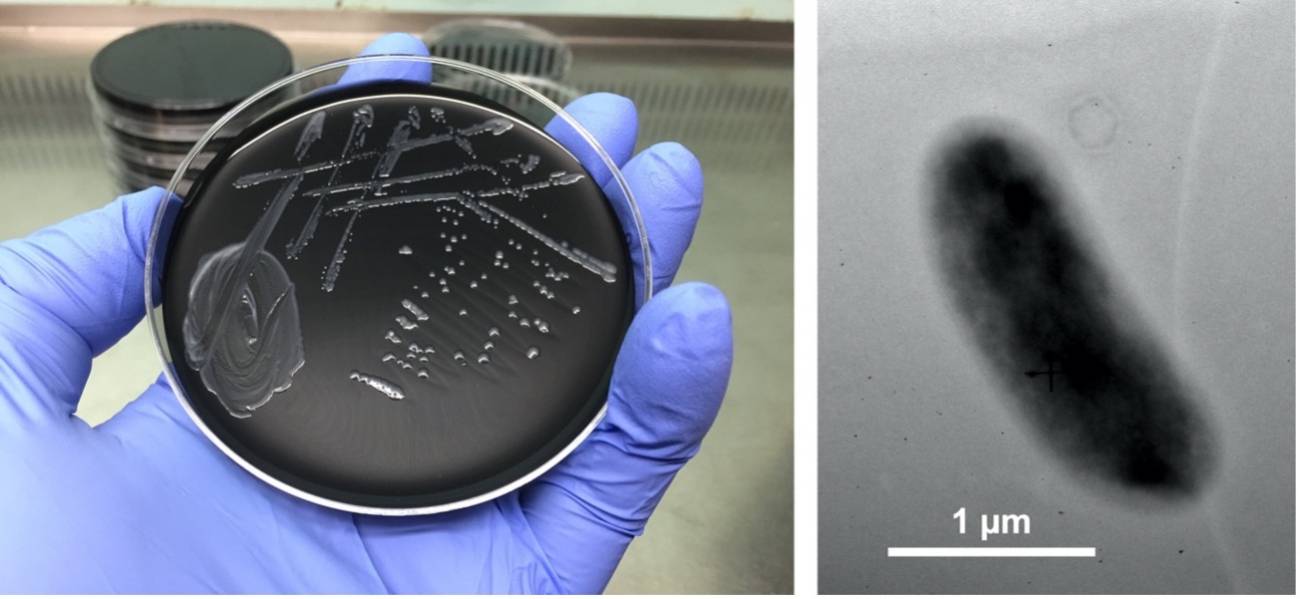 Descubierta una nueva especie de legionella en Mallorca