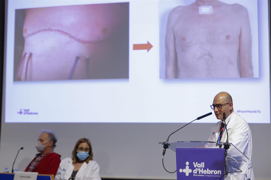 Hospital español practica primer trasplante pulmonar robótico sin abrir tórax