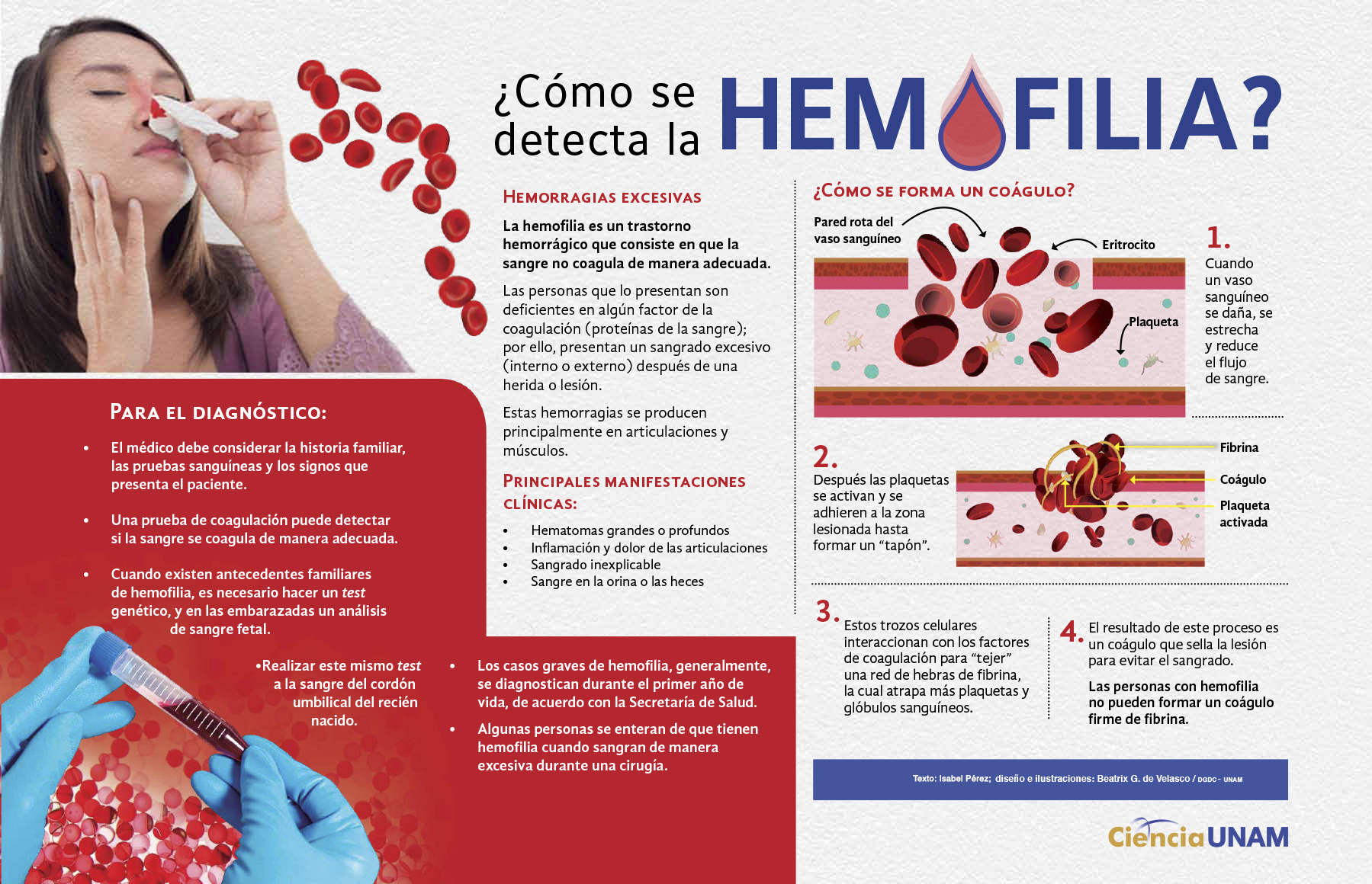 En el Día Mundial de la Hemofilia. La hemorragia hereditaria