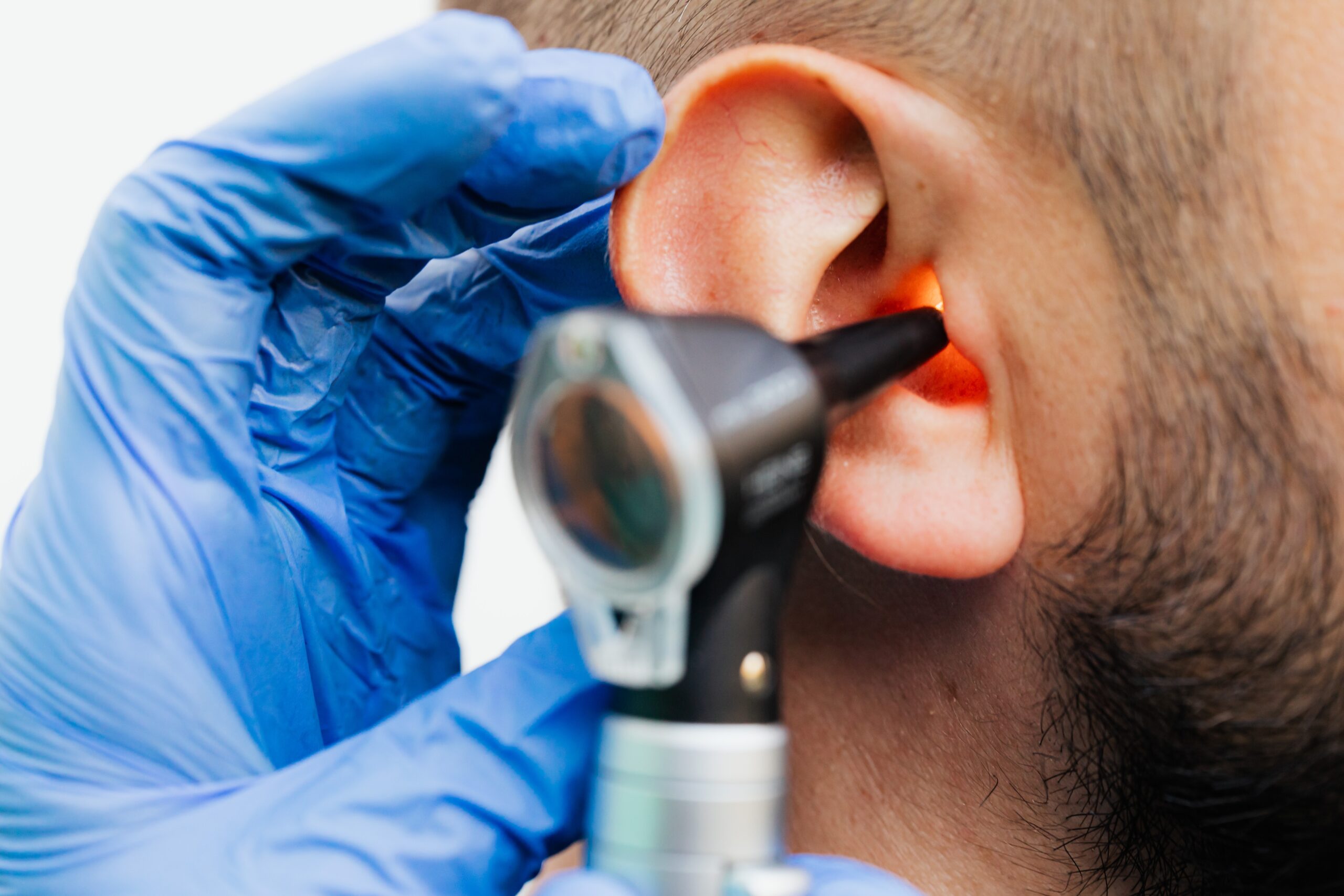 Otitis externa: ¿Qué es y cómo tratarla?