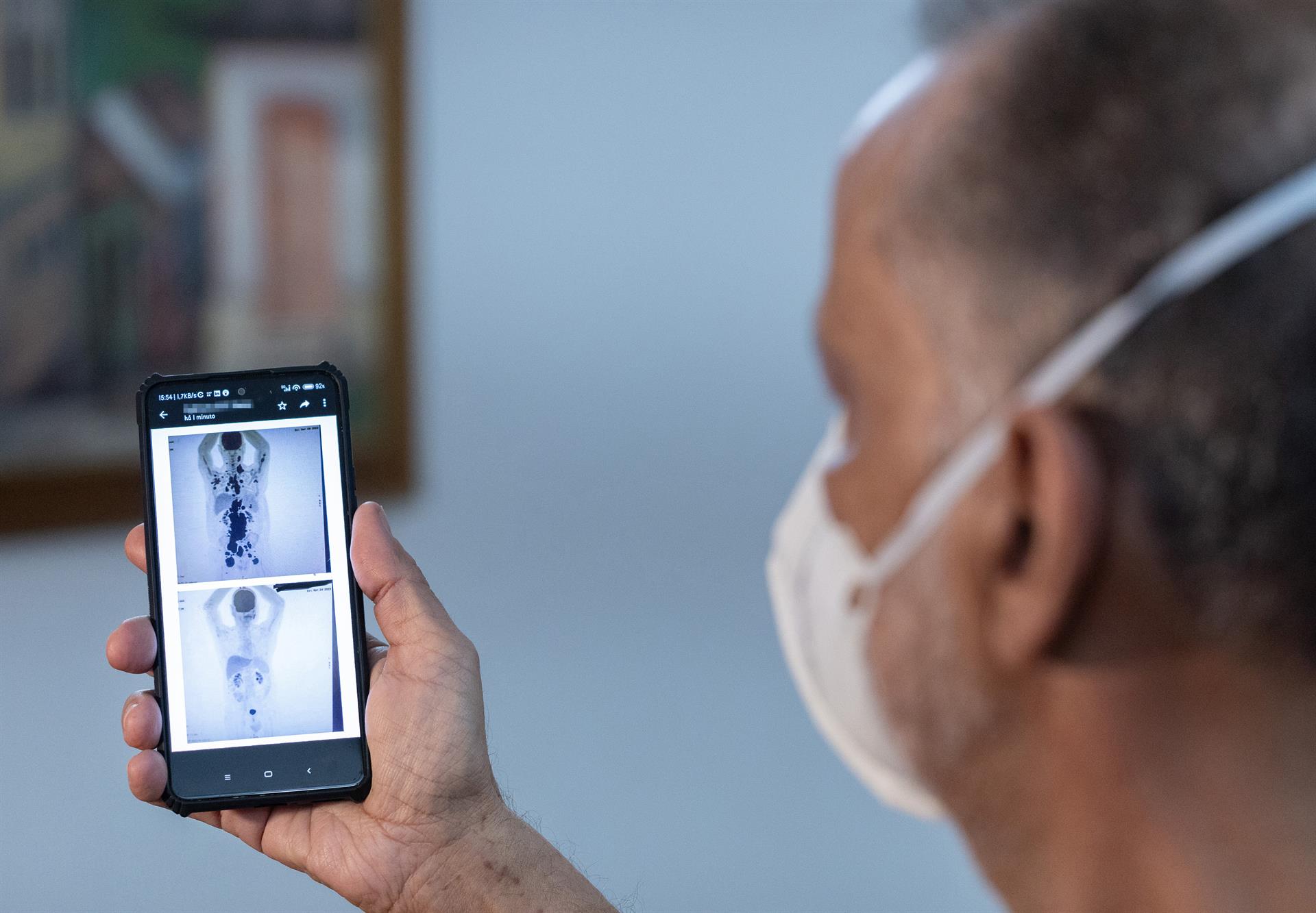 Terapia con células T, libera de cáncer a un paciente en Brasil