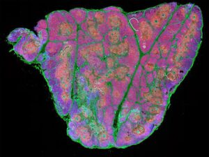 Identifican células madre en el timo, una posible vía para reforzar el sistema inmunitario