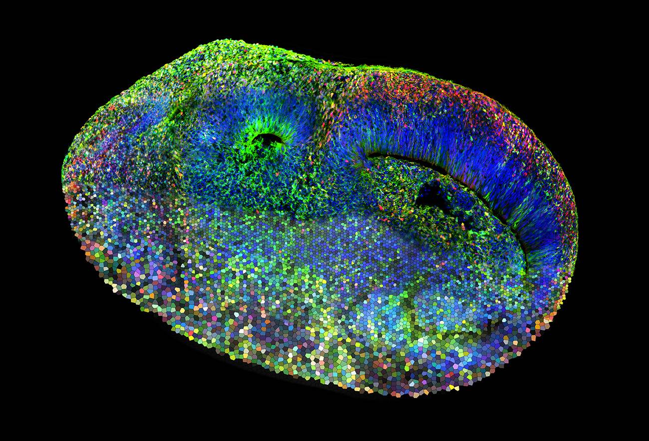 Organoides cerebrales para desvelar los enigmas genéticos del autismo