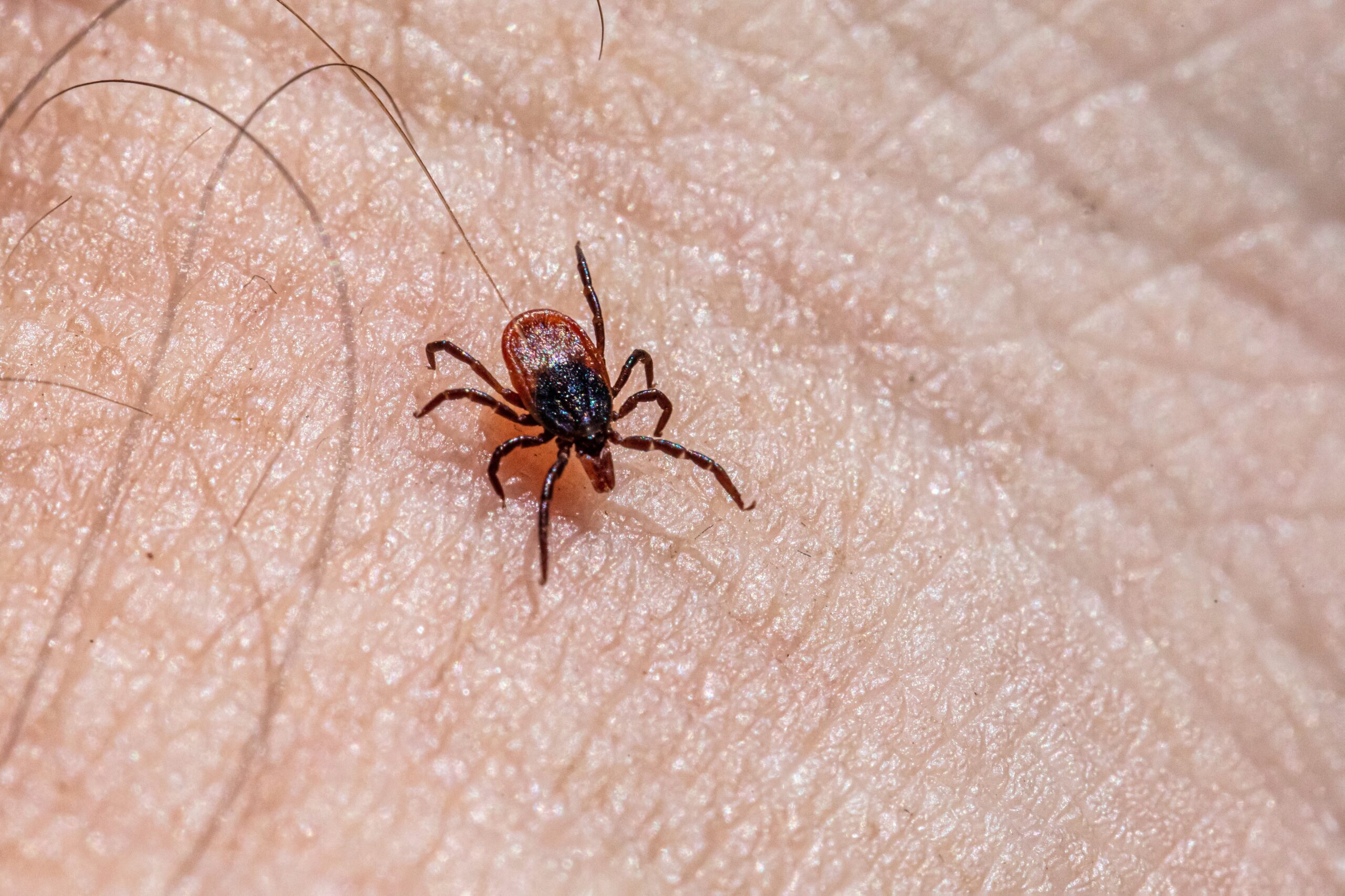 EEUU alerta de enfermedad transmitida por una garrapata