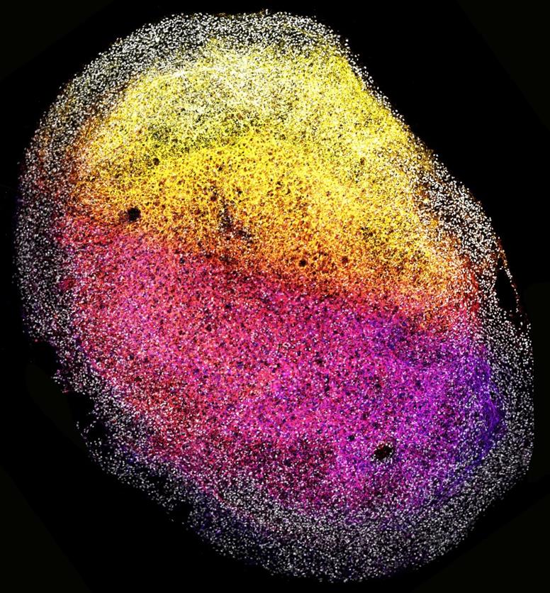 Desarrollan organoides cerebrales derivados de tejido cerebral fetal humano