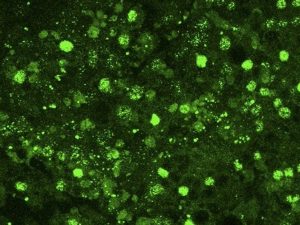Identificada-una-proteina-esencial-en-la-regulacion-de-la-obesidad