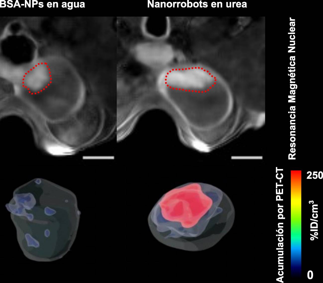 Los tumores de vejiga se reducen en un 90 % con el uso de nanorrobots