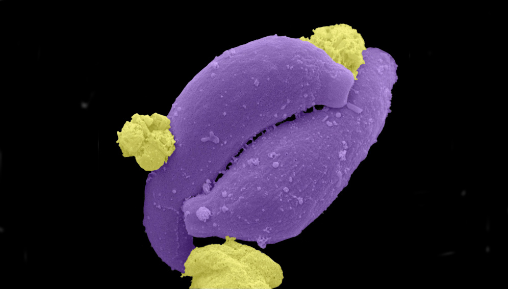 Herramientas ultrasensibles detectan malaria asintomática