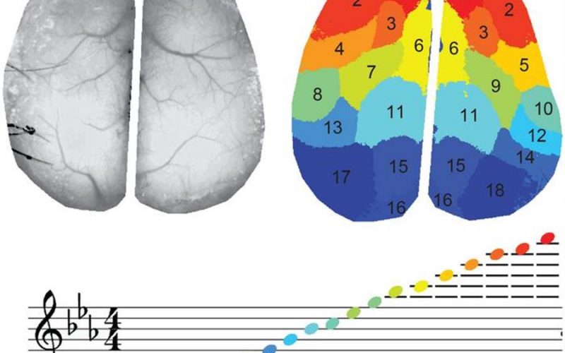 La actividad cerebral traducida a color y música para facilitar su interpretación médica